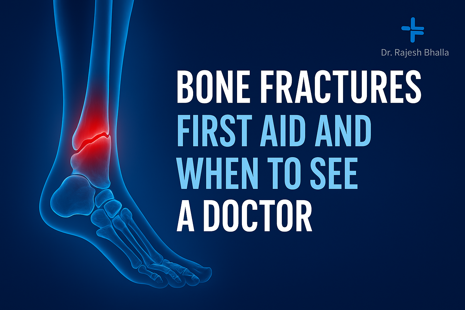 Bone Fractures