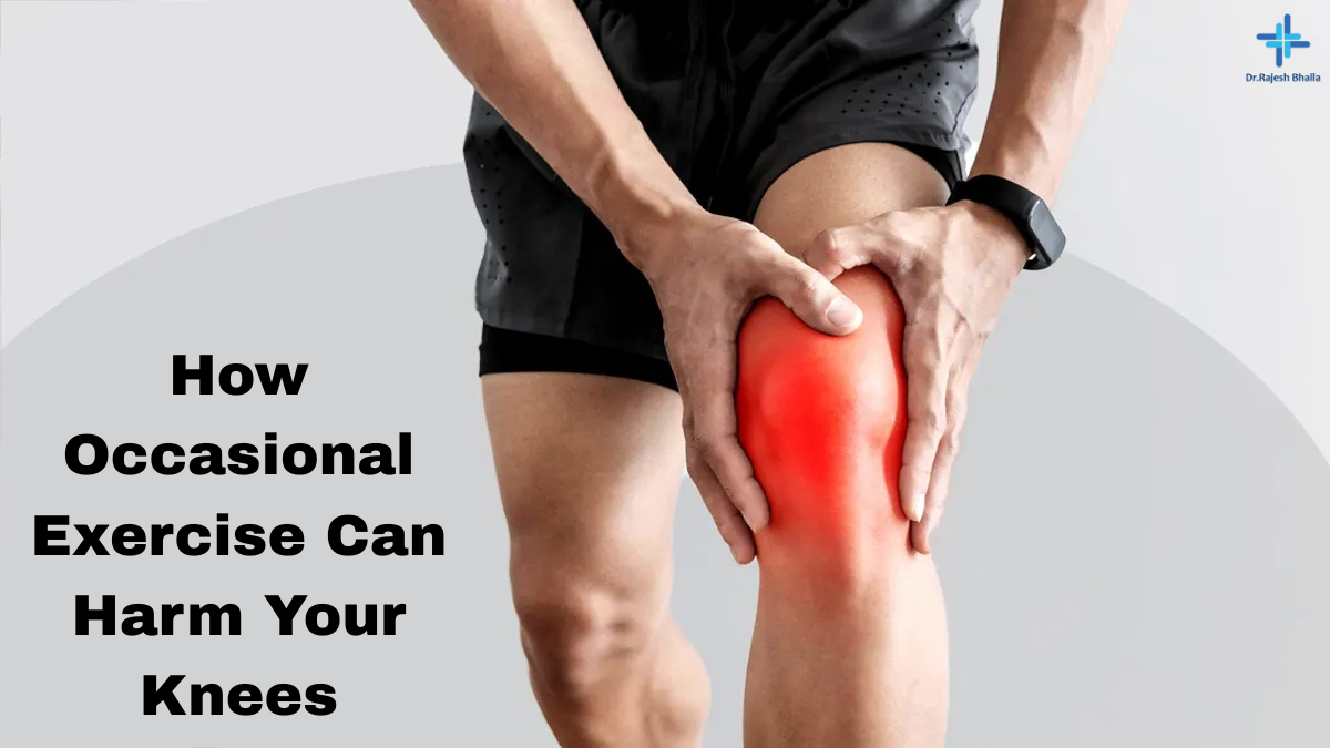 How Occasional Exercise Can Harm Your Knees